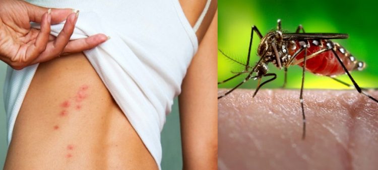 Οδηγίες για την προστασία από τα κουνούπια