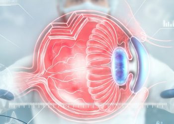 Νέα και πρωτοποριακή επέμβαση διόρθωσης υψηλής μυωπίας, αστιγματισμού και υπερμετρωπίας εφαρμόζει η κλινική ΟΡΑΣΗ